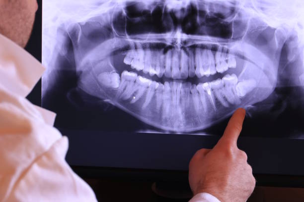 Bangor Base, WA Emergency Dentist Pros