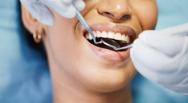 Best Emergency Root Canal Treatment in Bangor Base, WA